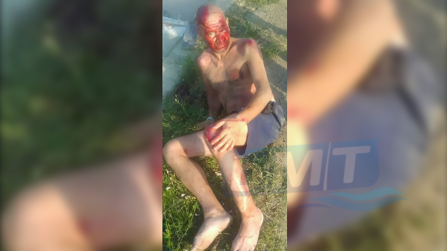 Жестока катастрофа с пострадал край Слънчев бряг, свидетели твърдят, че шофьорът избягал (СНИМКИ)