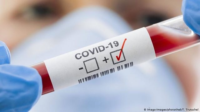 Над 48 милиона души в света са заразените с COVID-19