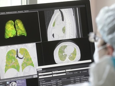 Безплатни прегледи за пост-Ковид синдром ще се провеждат в белодробната болница и комплексния онкологичен център