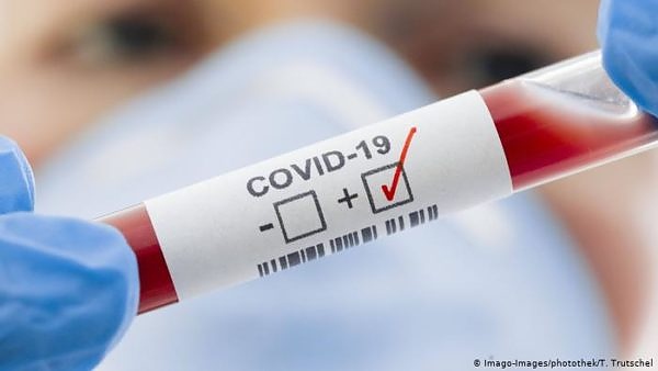 Рекорден брой новозаразени с COVID-19 в Германия